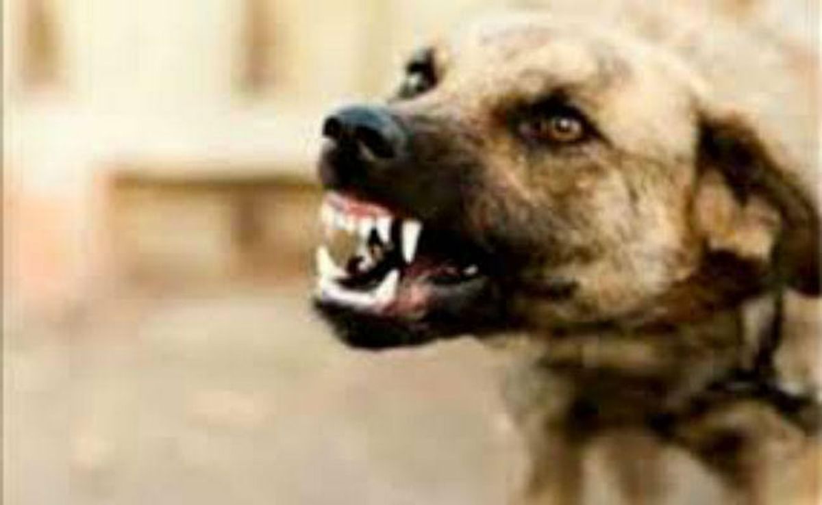 Pitbull's terror again in Meerut, attacked a girl playing outside the house, got teeth in many places, hospitalized