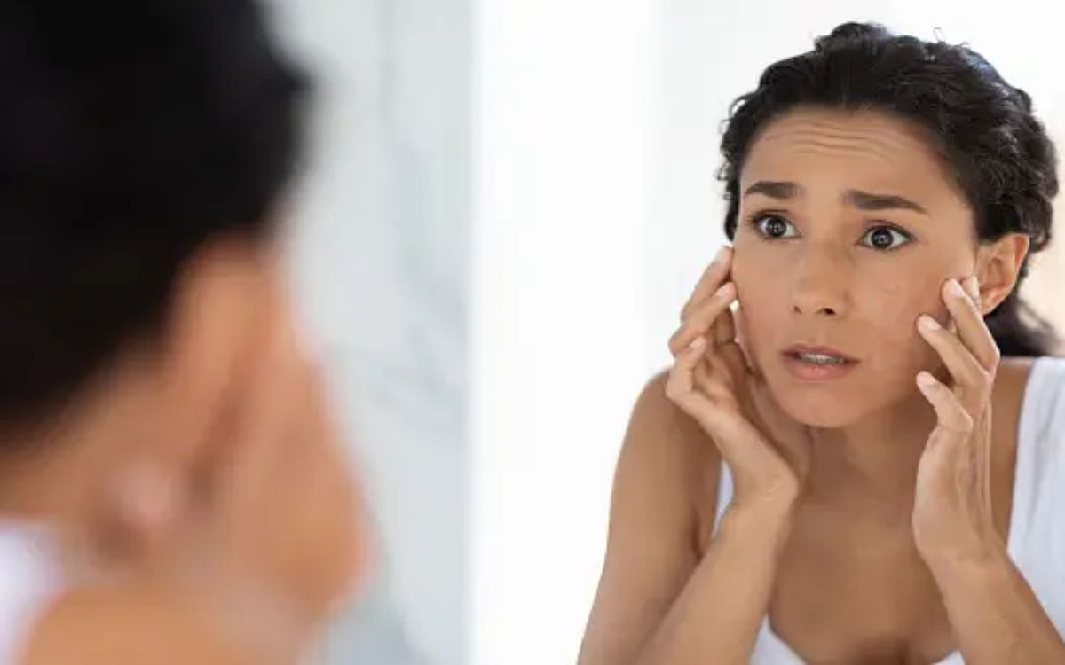 Beauty tips: Are pimples affecting beauty, know the secrets of glowing skin