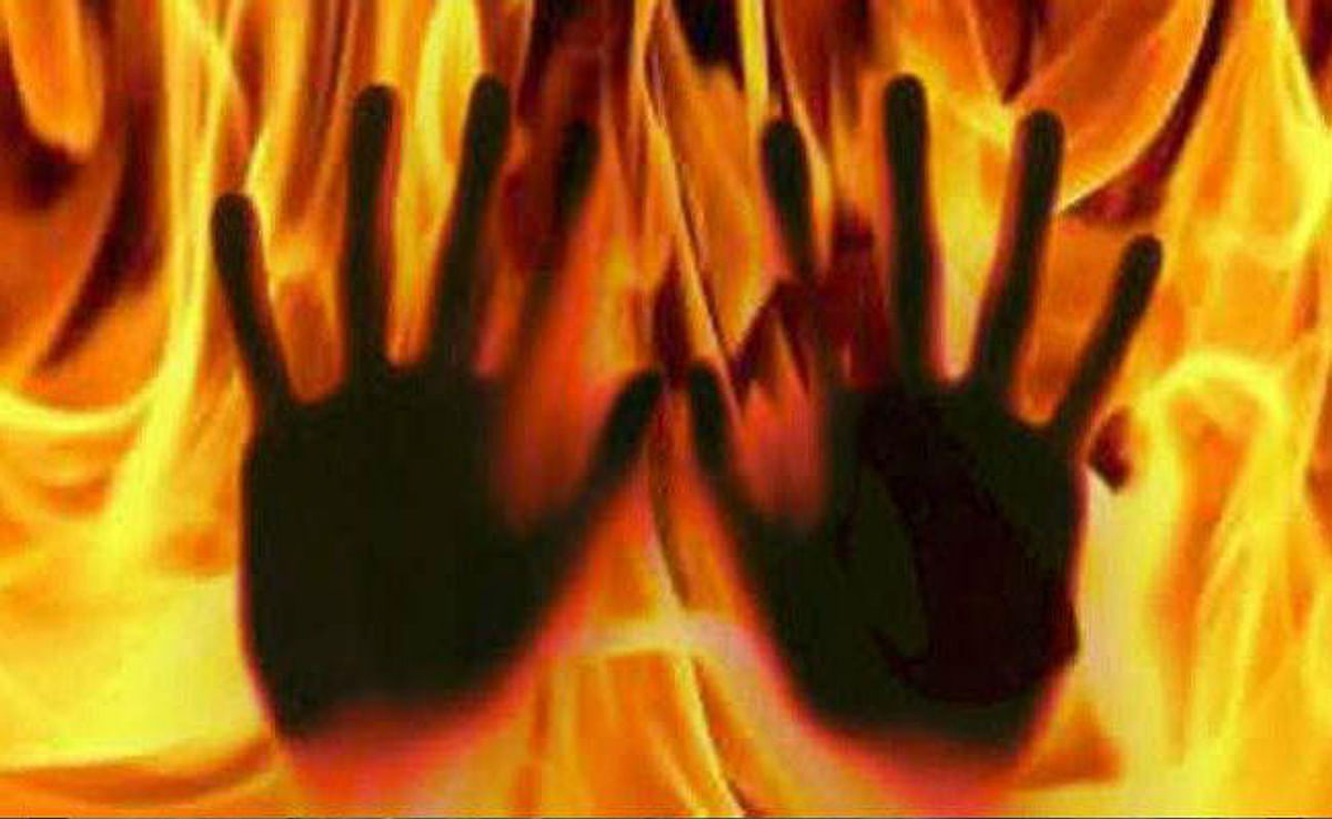 Mother-in-law burnt son-in-law alive in Hajipur, black son-in-law was not liked for fair daughter