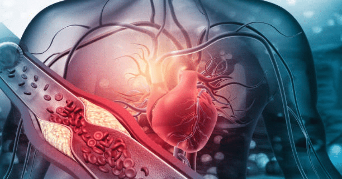 Health Care: Bad cholesterol wreaks havoc on the heart, know ways to reduce it naturally