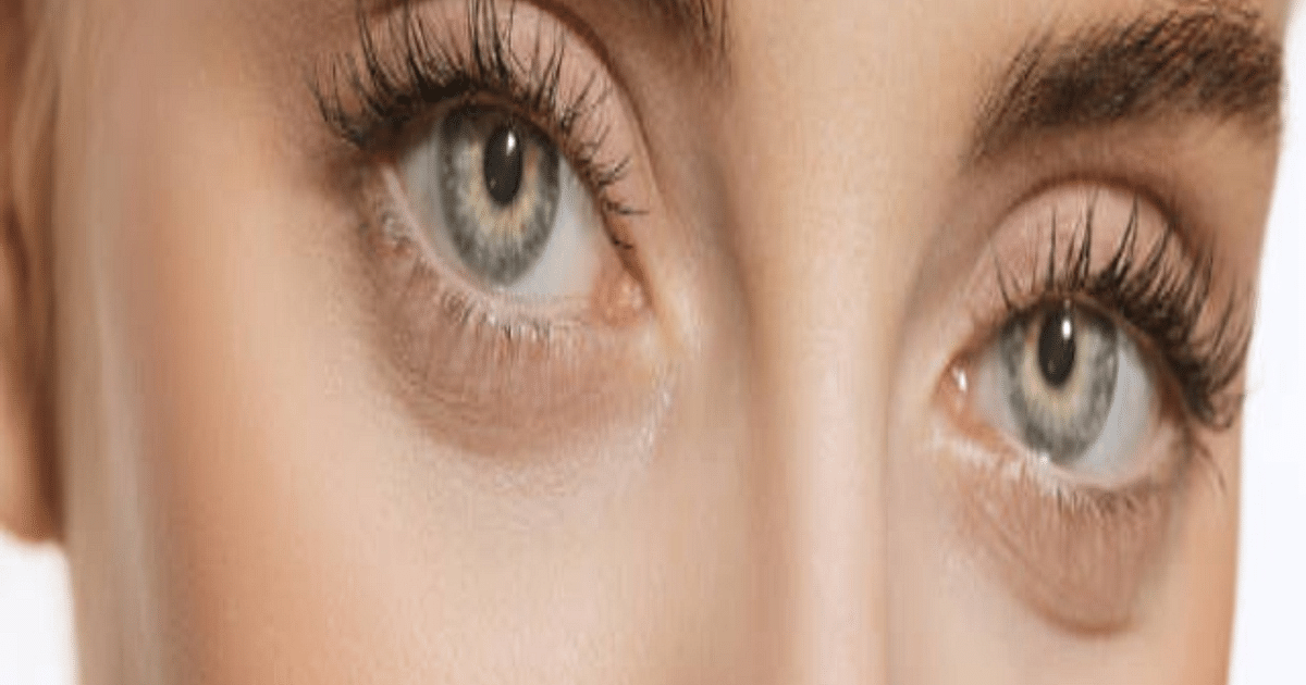 What looks blurry to you?  Try home remedies to improve eyesight