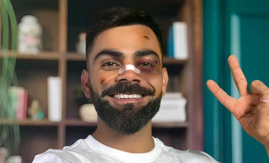 Is Virat Kohli really injured, know why such a picture was uploaded