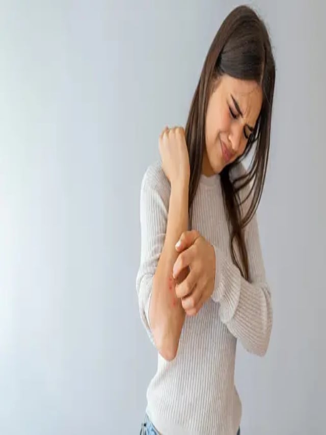 If you are troubled by skin allergies and itching, these home remedies will give relief.