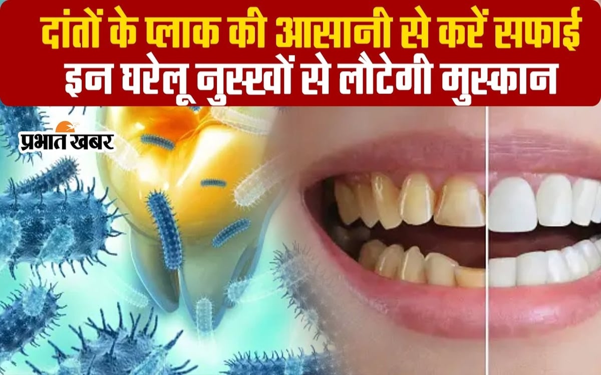 VIDEO: Do not ignore teeth cleaning, remove plaque and bring back your beautiful smile, try these remedies