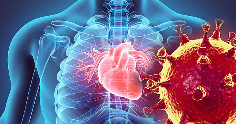 What is Corona's connection with heart attack, know from the expert how you can save your life in case of heart attack.