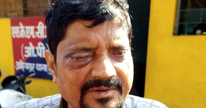 Constable used baton during vehicle checking in Muzaffarpur, lawyer's eye was injured, SSP took action