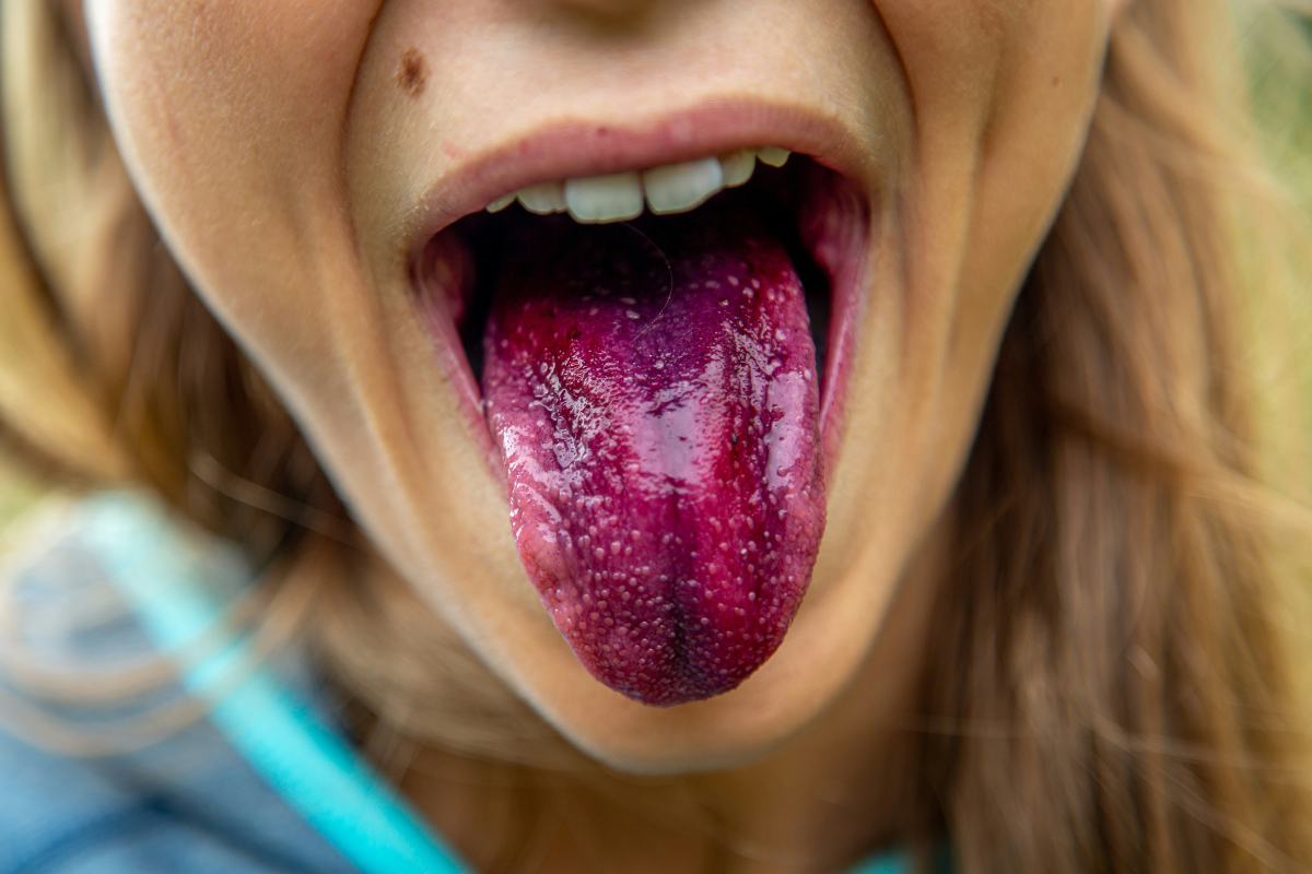 Health Tips: Know your health condition from the color of your tongue